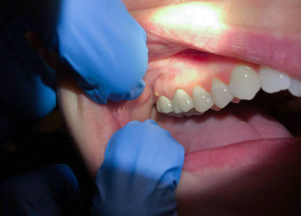 Best Cosmetic Emergency Dentistry in Glenwood, MN