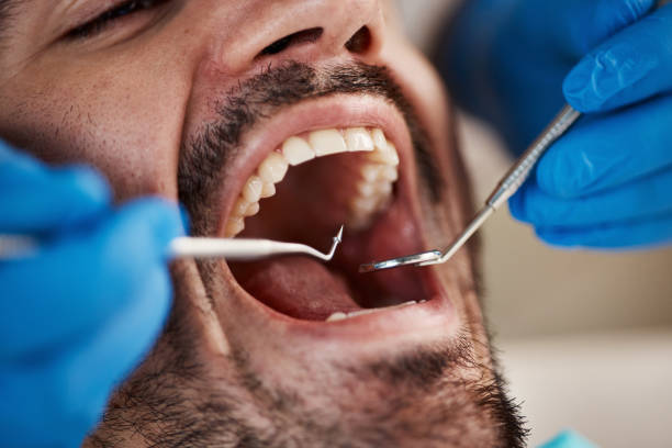 Best Emergency Treatment for Dental Infections or Abscesses in Glenwood, MN