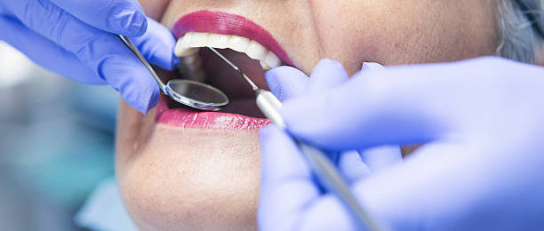 Best Emergency Root Canal Treatment in Glenwood, MN
